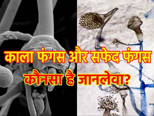 Black Vs White Fungus: ब्लैक फंगस और व्हाइट फंगस में फर्क, जानिए लक्षण और उपचार Black Vs White Fungus: ब्लैक फंगस और व्हाइट फंगस में फर्क, जानिए लक्षण और उपचार
